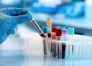 Introduction of blood test for early detection of diabetes in children