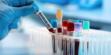 Introduction of blood test for early detection of diabetes in children