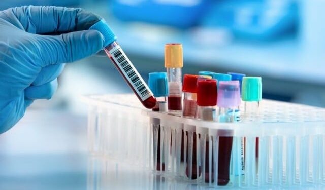 Introduction of blood test for early detection of diabetes in children