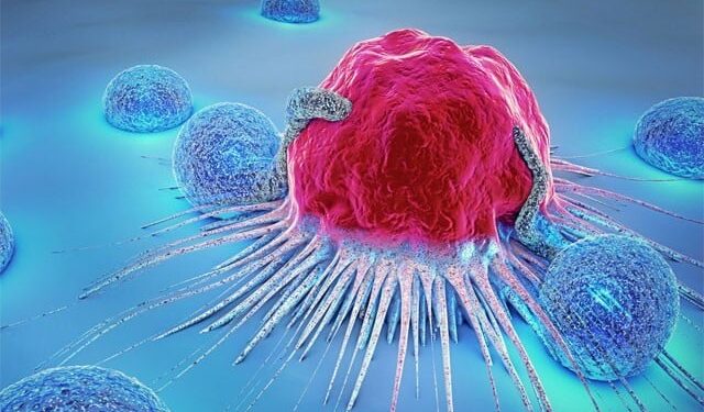 20% of cancer patients in Pakistan are suffering from blood cancer, expert