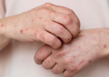 Scientists warn of 'silent epidemic'