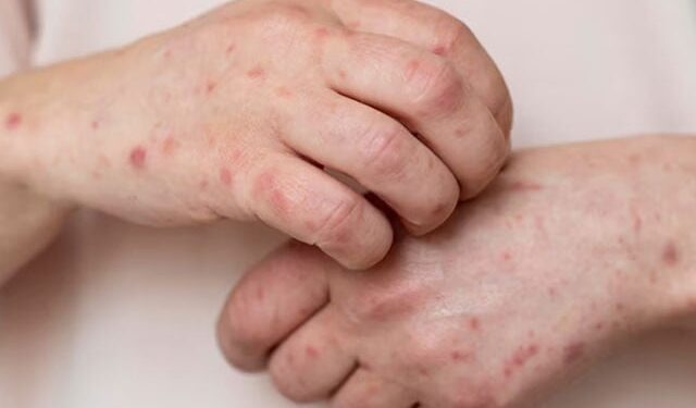 Scientists warn of 'silent epidemic'