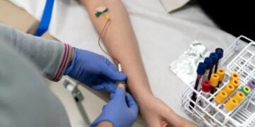 A blood test can detect heart disease in women decades earlier