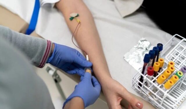 A blood test can detect heart disease in women decades earlier