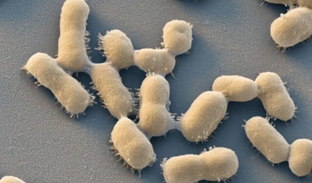 Drug-resistant infections predict 30 million deaths by 2050