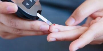 People taking steroids have a higher risk of diabetes