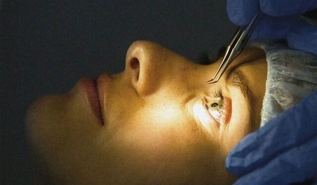 Major advances in retinal hole treatment