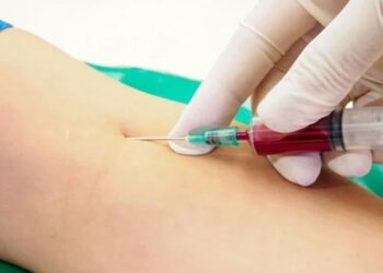 Timing of blood sampling may affect dementia diagnosis results, research