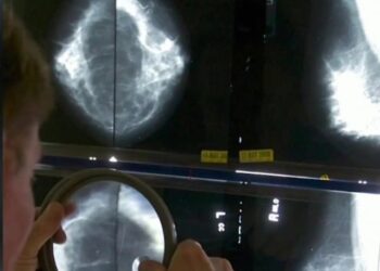 Early puberty increases the risk of breast cancer