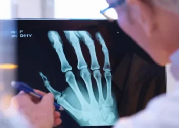 AI technology helps diagnose broken bones
