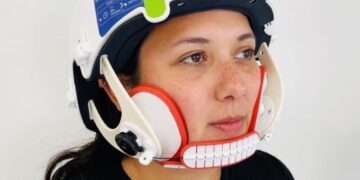 Modern helmet introduced to prevent hair loss in cancer treatment