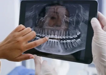 Gum disease and diabetes linked in a new study