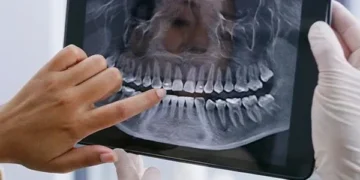 Gum disease and diabetes linked in a new study