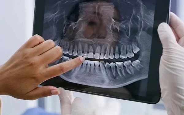 Gum disease and diabetes linked in a new study