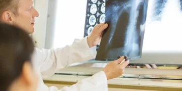 Cancer survival rates rise