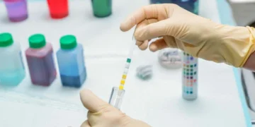 AI-powered urine analysis can help diagnose lung disease