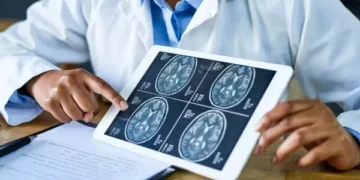 Men with heart disease more likely to develop dementia