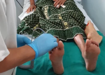 Most diabetic foot amputations can be prevented, experts say