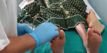 Most diabetic foot amputations can be prevented, experts say