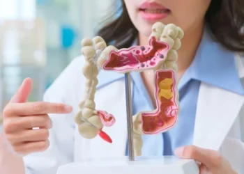 Rising cases of colorectal cancer, concern among experts globally