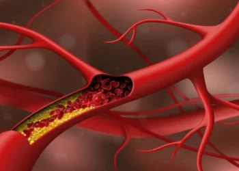 How High Cholesterol Can Increase the Risk of Brain Diseases Like Dementia and Alzheimer’s
