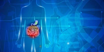 Why Is Bowel Cancer Becoming More Common in Young People? A Deep Dive Into the Rising Trend