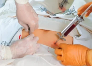 When Is a Stem Cell Transplant Necessary? A Complete Medical Guide