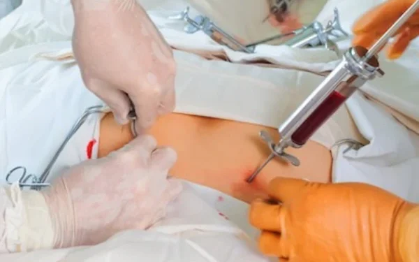 When Is a Stem Cell Transplant Necessary? A Complete Medical Guide