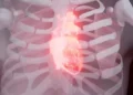 Six Major Signs That Indicate Your Heart Health Is at Risk