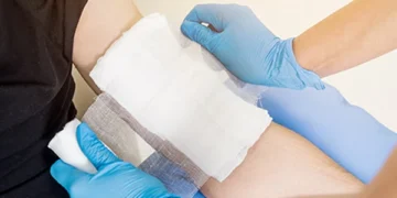 Chinese Scientists Develop Revolutionary ‘Magic Bandage’ to Heal Severe Burn Wounds